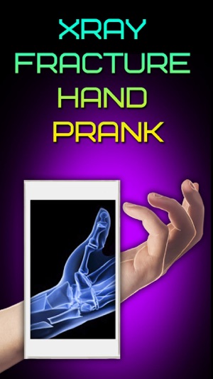 Xray Fracture Hand Prank(圖1)-速報App