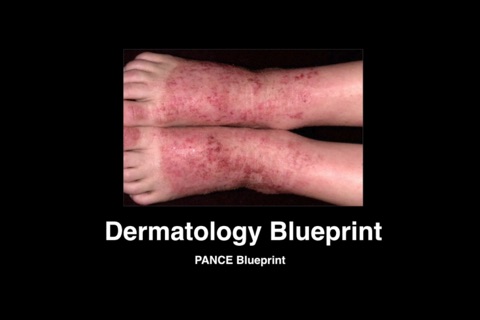 Dermatology Blueprint PANCE & PANRE Review Course screenshot 3