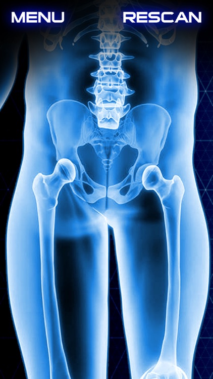 Xray Scanner Hip Bone Prank