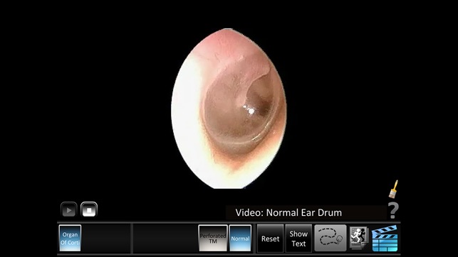 Ear Disorders: Inner(圖5)-速報App