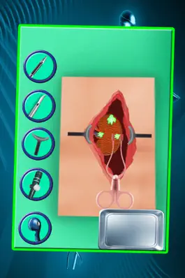 Game screenshot Kidney Surgery – Crazy surgeon & doctor hospital game for kids hack