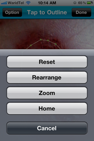 Wound Tracker Professional screenshot 3