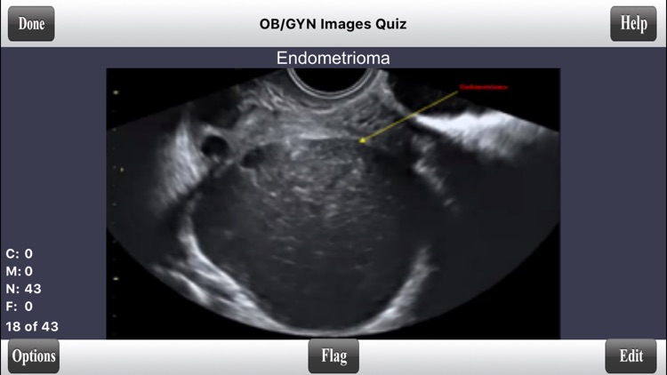 ARRT Sonography (Ultrasound) Flashcards screenshot-3