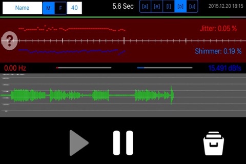 음성 분석 screenshot 4