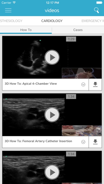 SonoAccess