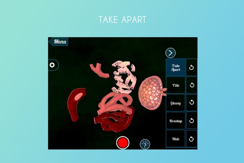 Malpighian Body 3D screenshot 4