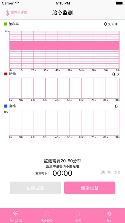 心动-孕期胎心监护