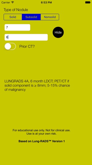 Single Nodule Lung Cancer Screening with Lung-RADS(圖4)-速報App