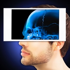 Activities of Xray Scanner Head Prank