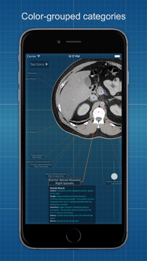 X-Anatomy Free(圖5)-速報App