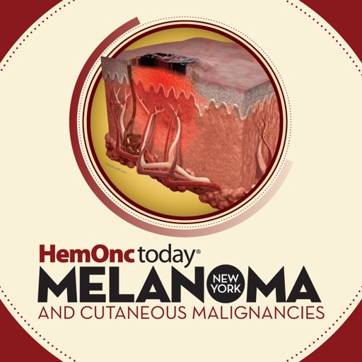 HemOnc Today Melanoma