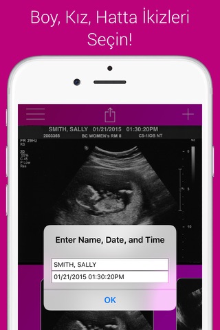 Ultrasound Prank Free - Pregnant Spoof And Fake Pregnancy Trick screenshot 2