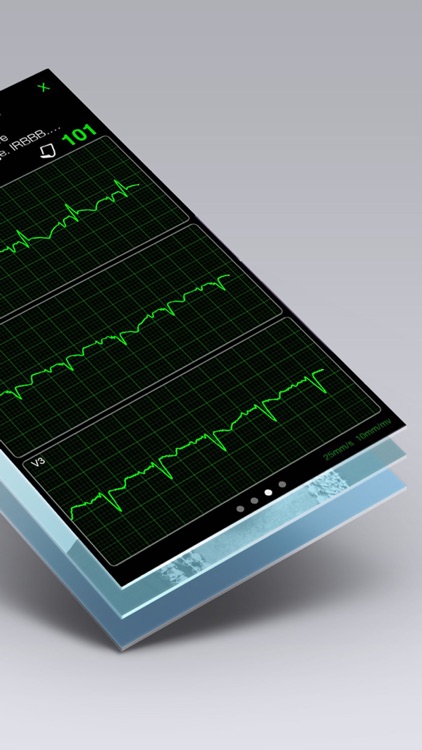 ECG Books - Cardiology Textbooks and Examples