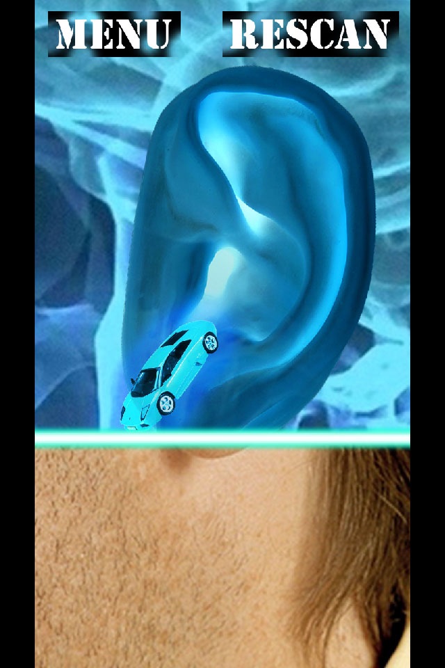 Xray Scanner Ear Prank screenshot 2