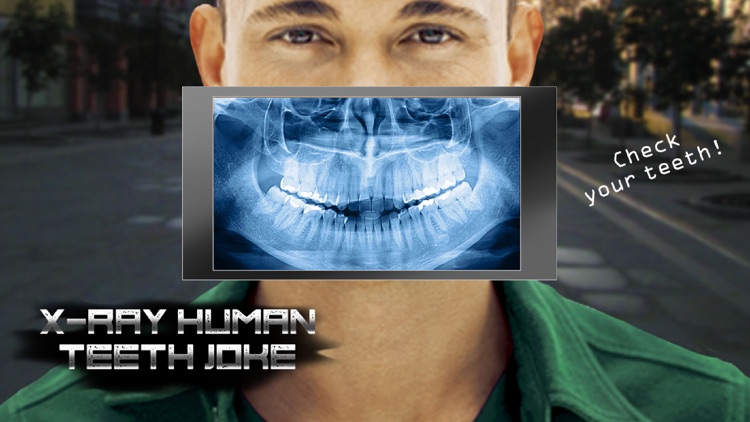 X-Ray Human Teeth Joke