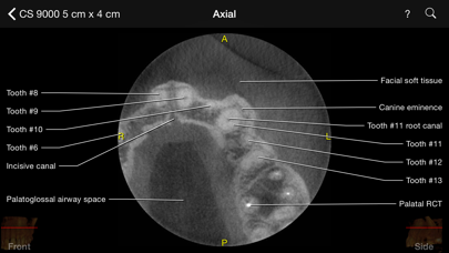 How to cancel & delete CBCT from iphone & ipad 3