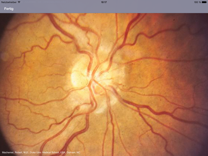Atlas of Ophthalmology HD by Onjoph
