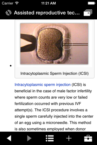 IVF screenshot 4