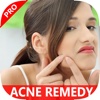 Learn How To Get Rid Of Pimples Fast - Best Natural ACNE Cure Treatment Right Now