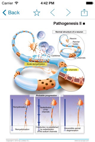 Miniatlas Multiple Sclerosis screenshot 4