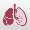 Lung Cancer Diagnostic App