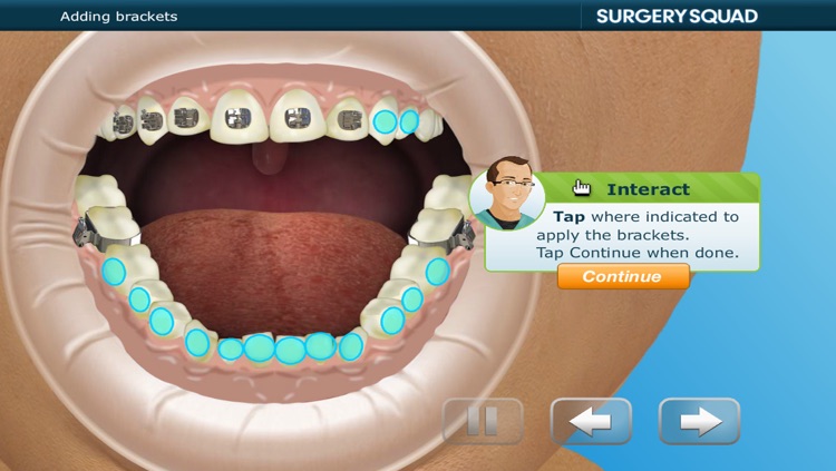 Virtual Braces screenshot-4