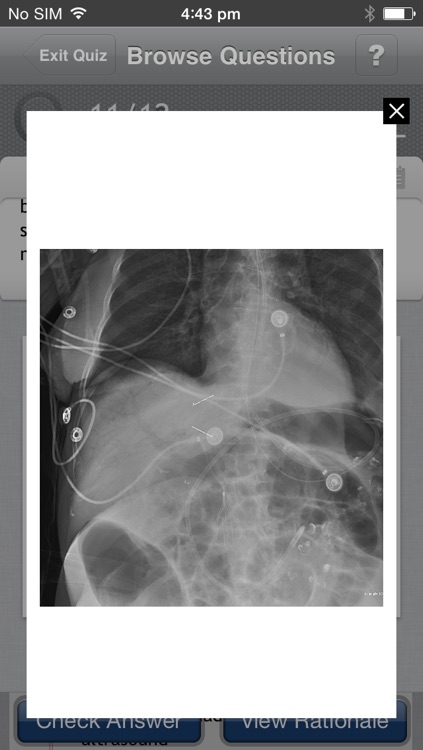 Neurocritical Care Q&A Board Review