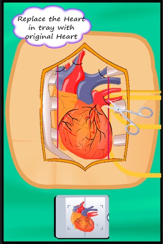 Heart Surgery : Free Virtual Heart Transplanet Games For Kids screenshot 4