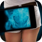 Top 50 Entertainment Apps Like Simulator X-Ray Photo Hip Bone - Best Alternatives