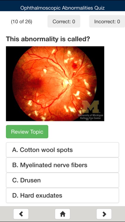 EyesHaveIt screenshot-4