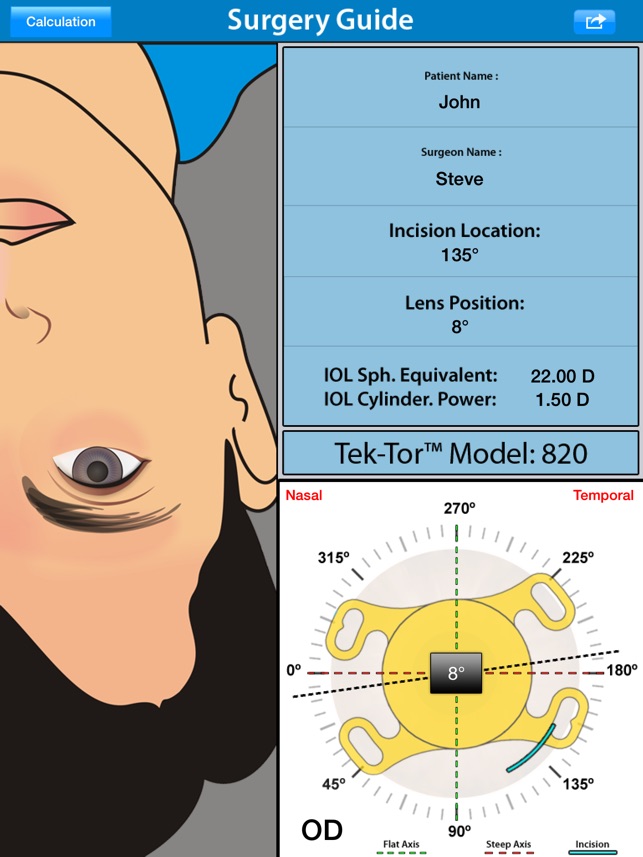 Tek-Tor™ Toric Calculator by TEKIA, Inc.(圖3)-速報App