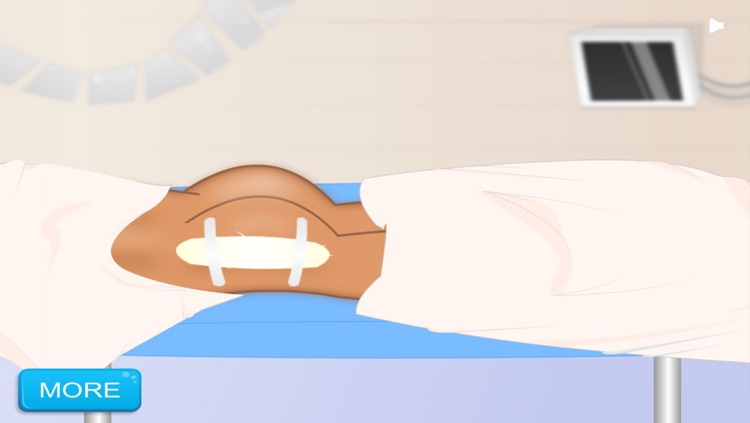 Hip Surgeon