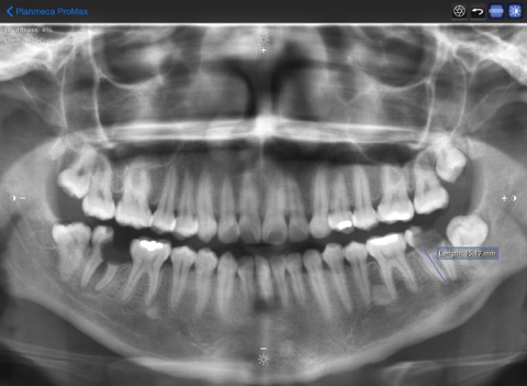 Planmeca iRomexisのおすすめ画像2