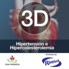 3D Hipertensión e hipercolesterolemia