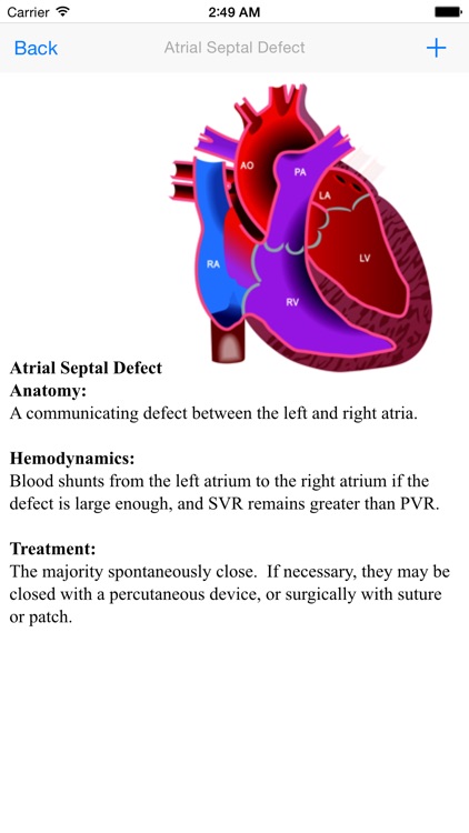 Congenital Heart Defect
