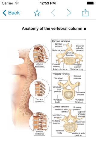 Miniatlas Diseases of the vertebral column screenshot 2