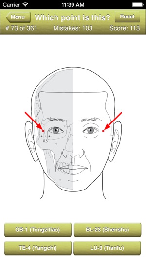 Acupuncture Points Quiz(圖2)-速報App