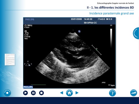 Echocardiographie chez l'enfant screenshot 2