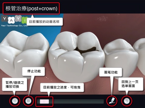 Dental Consult－English Audio Version screenshot 4