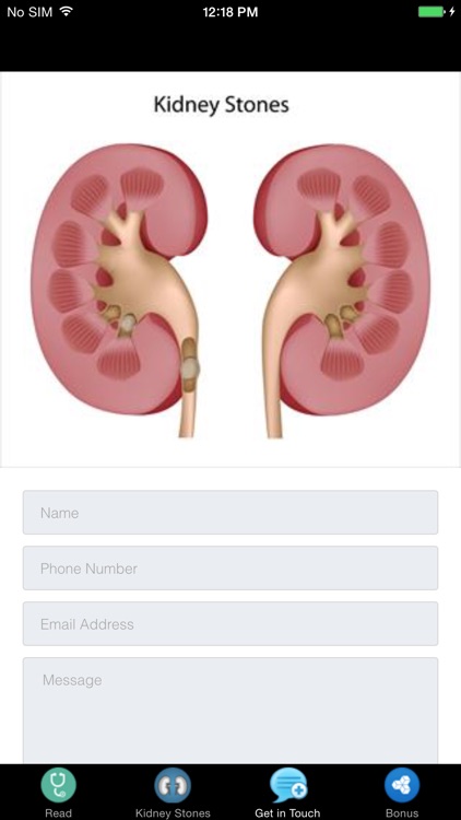 Kidney Stones Symptoms - Treatment Information