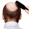 Best Hair Transplant Pre-Procedure, Preparation and Process Guide & Tips Made Easy for Beginners