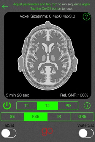 MRI Simulator screenshot 2