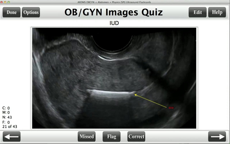 ARDMS Ultrasound Flashcards Board Review Lite thumbnail 1