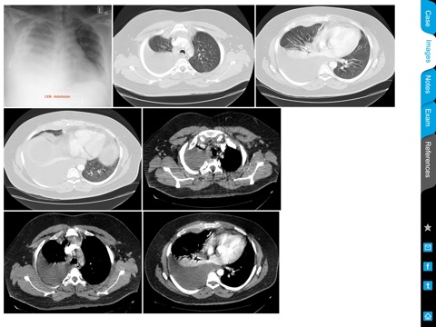 ACCP Radiology Cases screenshot 4