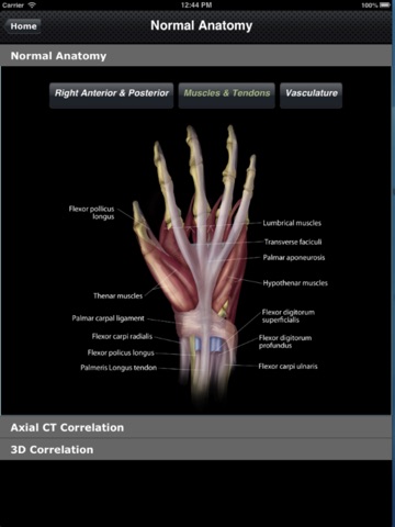 CTisus: CT of the Hand & Wrist screenshot 4