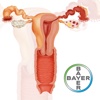 Gynecology Mini Atlas
