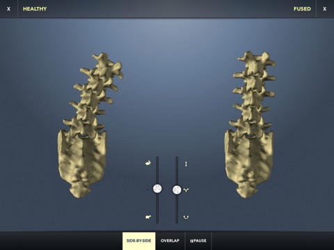 The Kinetic Spine (Free) screenshot 3
