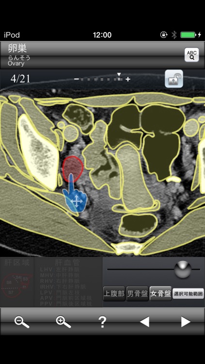 断面図ウォーカー女性骨盤CT無料版