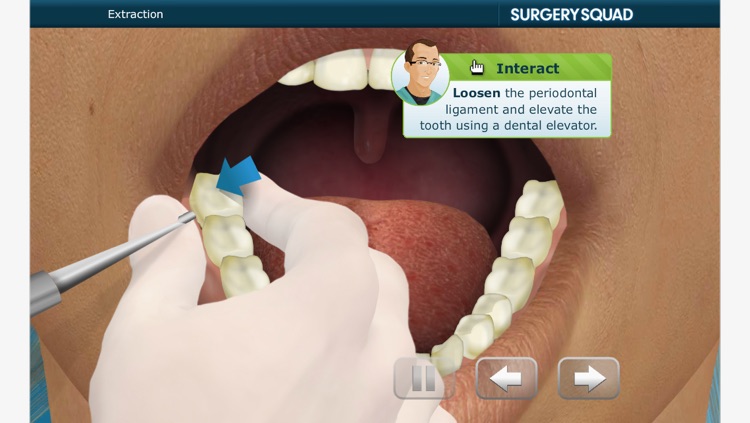 Surgery Squad's Wisdom Tooth Extraction