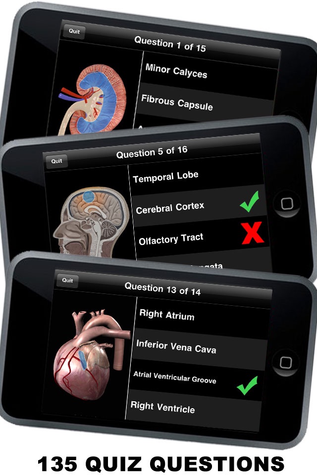 Anatomy 3D - Organs screenshot 2